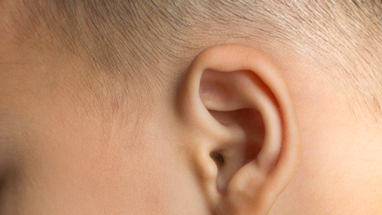 Article sur l'otoplastie mini-invasive des oreilles - Dr Marchac Paris 16