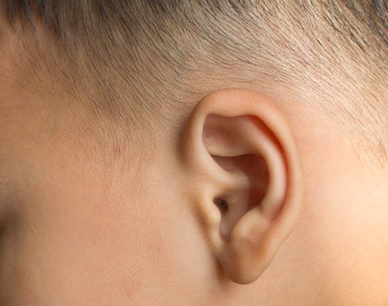 Article sur l'otoplastie mini-invasive des oreilles - Dr Marchac Paris 16
