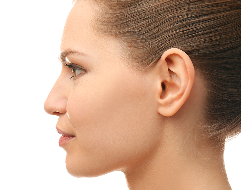 Une fois posé, l'implant Earfold est invisible sous la peau de l'oreille