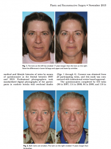 Médecine esthétique du visage : effets du tabac sur le visage. Comparaison entre les vrais jumeaux