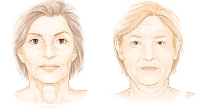 Les signes de vieillissement du visage