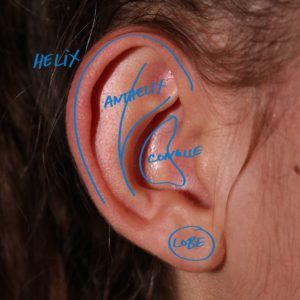 Oreille décollées et anatomie de l'oreille - Dr Marchac Paris 16