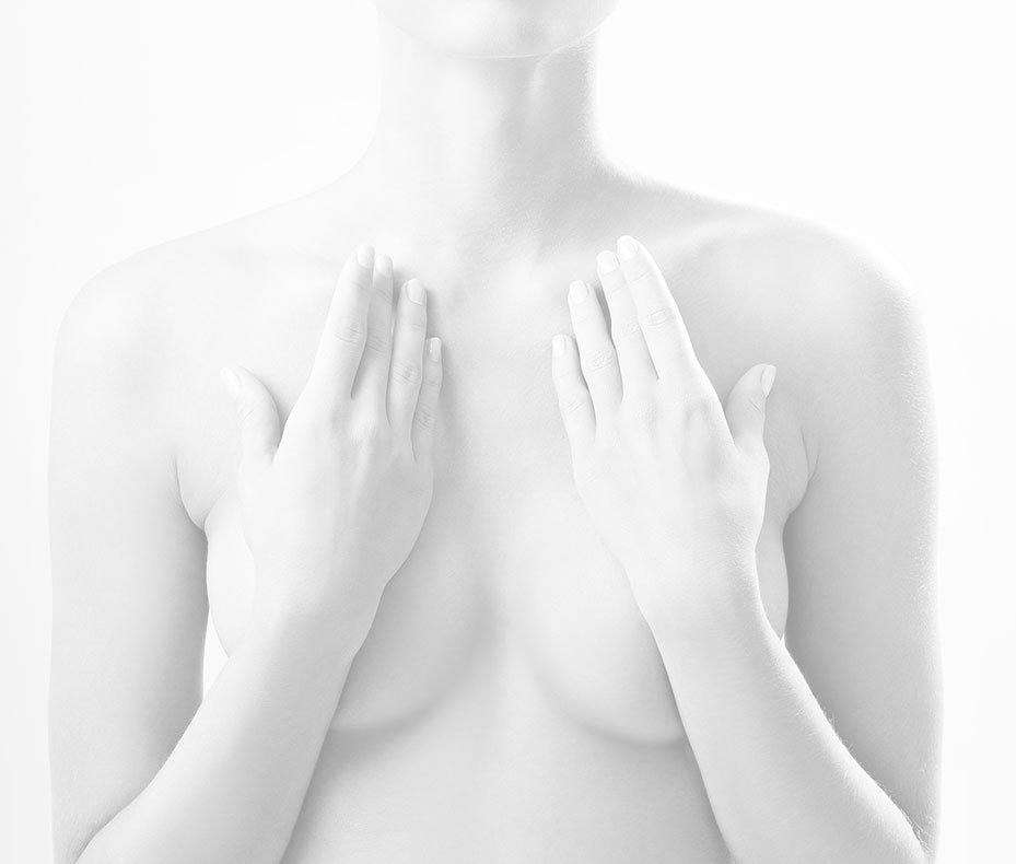 Lifting mammaire à Paris 16 - Chirurgie des seins | Dr Marchac